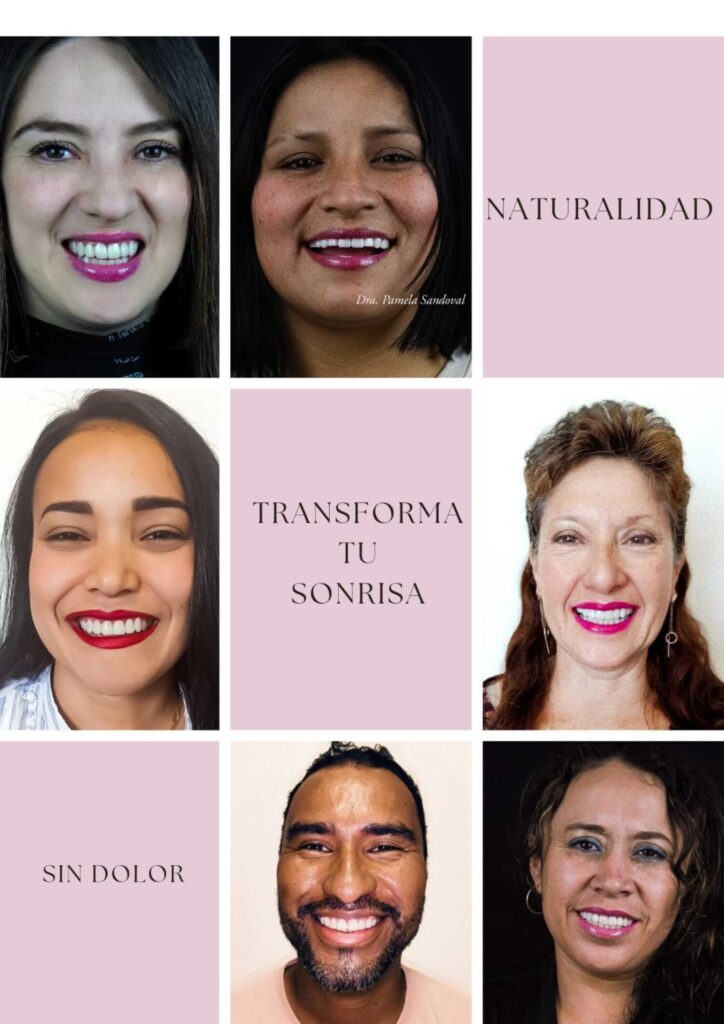 diseño de sonrisa natural